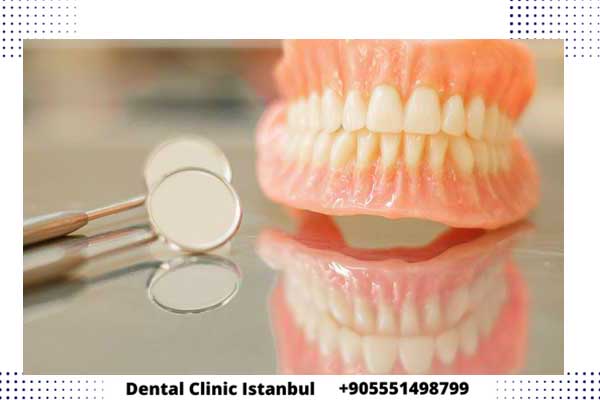 أفضل مراكز زراعة الاسنان في تركيا - الخدمات و النتائج و التجارب