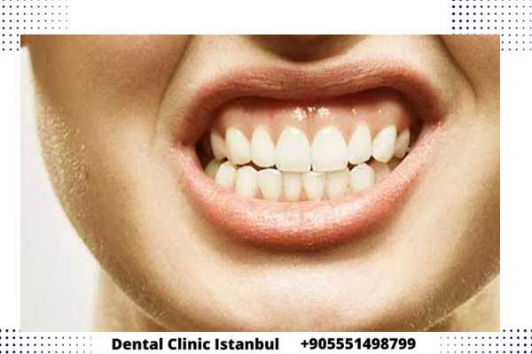 التهاب اللثة بعد زراعة الأسنان في تركيا - أهم النصائح
