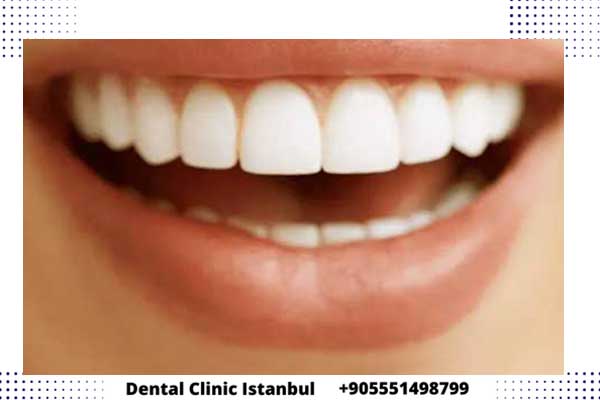 الفرق بين زراعة الأسنان الفورية والتقليدية في تركيا