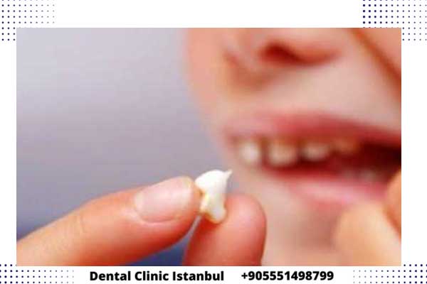 اهمية زراعة الاسنان في تركيا – الخطوات و التكاليف و التجارب