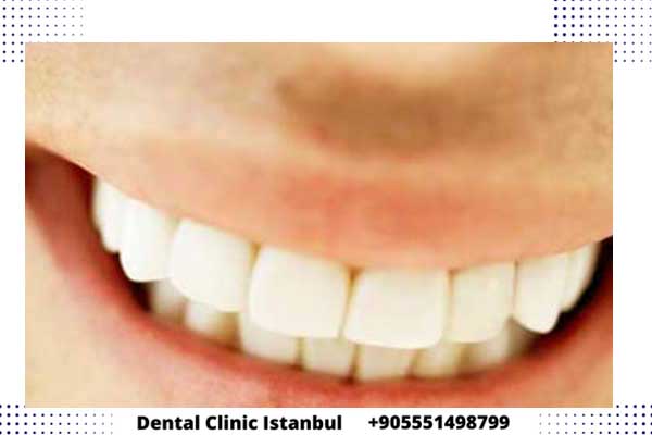 تجارب الناس مع زراعة الأسنان في تركيا و أهم التوصيات