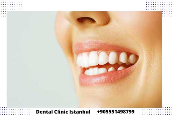 زراعة الاسنان الاماميه في تركيا - معلومات هامة لصحة أسنانك