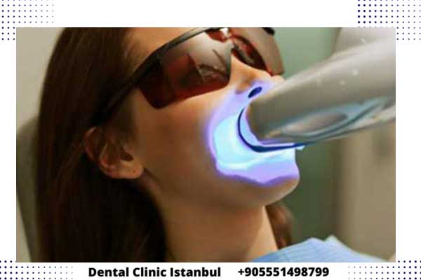 زراعة الاسنان بالليزر في تركيا – مميزات وعيوب تقنية الليزر للأسنان