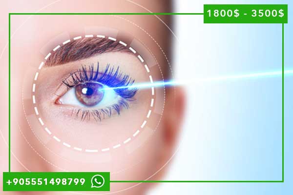 عملية ليزر للعيون في تركيا: دليل شامل للتكلفة، الفوائد، والتجارب
