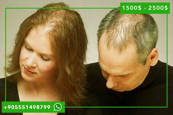 تكلفة زراعة الشعر في تركيا بالدينار الجزائري: دليل شامل مع المشاعر الإيجابية