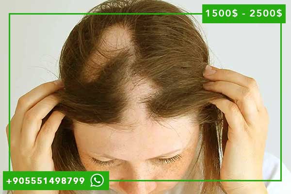 زراعة الشعر بدون حلاقة في تركيا