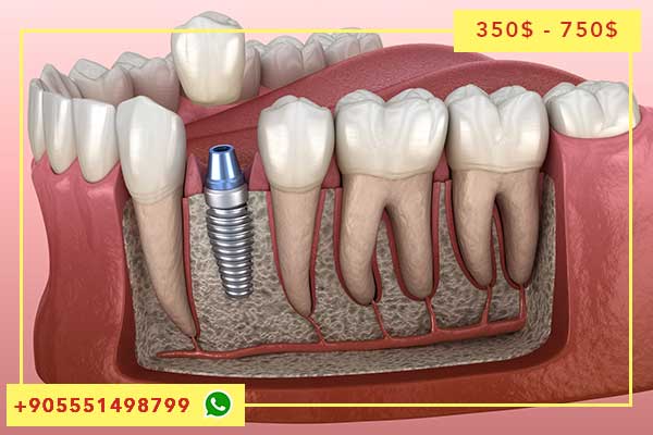 💎 اكتشف الموقع الرسمي لمركز طب الأسنان في تركيا: كامل التفاصيل وتجارب مفصلة 💎