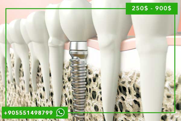 Comprehensive Dental Implant Packages in Turkey: Your Complete Guide to Premium Dental Care in 2025