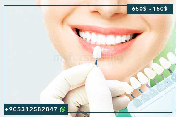 Traitement Dentaire en Turquie 2025 : Guide Complet pour des Soins Dentaires de Qualité à Prix Abordables