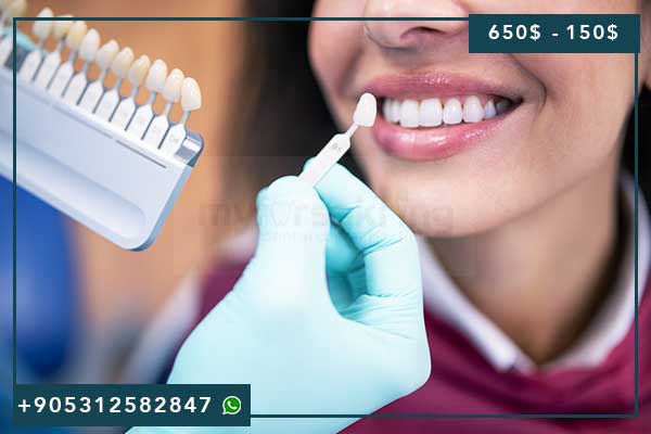 Dentisterie en Turquie 2025 : Guide Complet des Soins Dentaires et Prix Attractifs