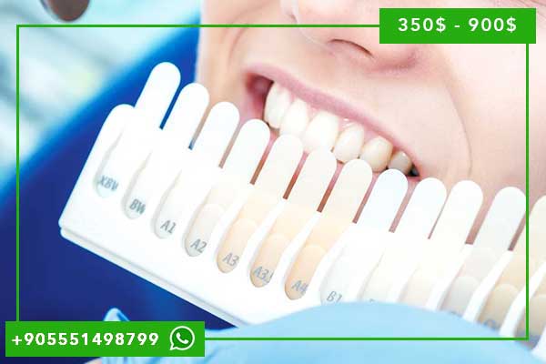 Carillas Dentales Turquía