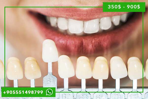 Clínica Dental en Turquía 2025: La Guía Completa para Tu Sonrisa Perfecta