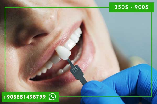 Cuánto Cuesta un Implante Dental en Turquía 2025: Guía Completa de Precios y Ahorros