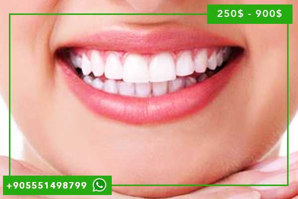 🦷 Blanchiment des Dents Istanbul 2025 : Guide Complet des Prix, Techniques Révolutionnaires et Cliniques d&rsquo;Excellence