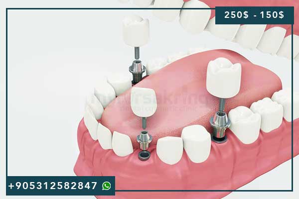 🏆 Meilleure Clinique Dentaire Turquie 2025 : Guide Complet des Avis Patients et Prix Imbattables