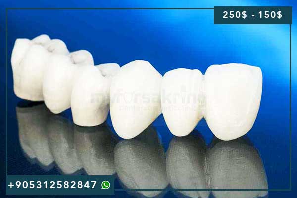 Prix Couronne Dentaire Turquie 2025 : Guide Complet et Tarifs Actualisés