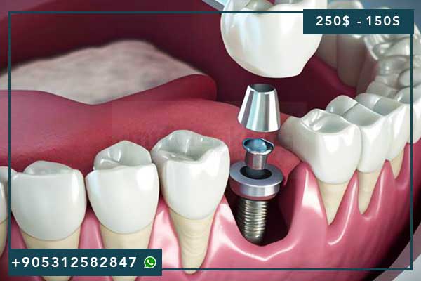 🦷 Traitement Dentaire à Istanbul 2025 : Révolution du Tourisme Médical et Excellence Dentaire Turque