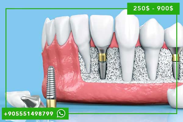 🏖️ Vacances + Traitement Dentaire Istanbul 2025 : L&rsquo;Alliance Parfaite du Tourisme et des Soins Dentaires de Qualité ✈️🦷