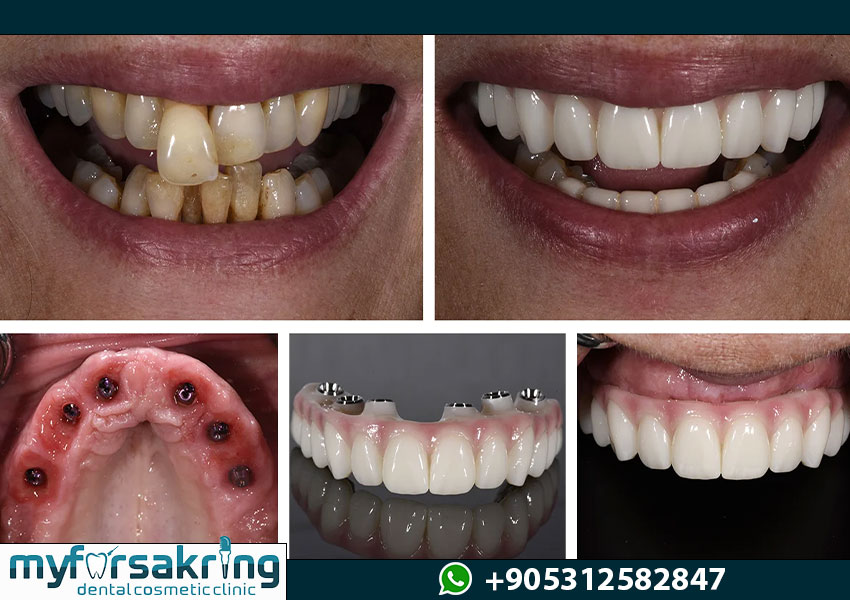 Luxury Patient Consulting Room Istanbul